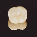 다이아몬드치과기공소 이미지