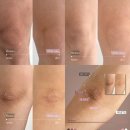 더멜라닌 바디케어 후기