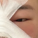 셀피성형외과