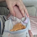 늘푸른의원 | 신생아 늘푸른소아과의원 설소대 수술 + BCGㆍB형 간염 예방 접종 후기