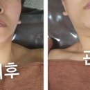 오늘은밝은피부 이미지