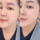셀메딕스 | 셀메딕스 바이오셀 멀티 미스트 토너 솔직 사용기