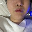 조선대학교 의학전문대학원 | 피부톤·비대칭이 동시에 개선된 관리[진접피부관리 해밀피부전문점]