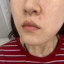 신유베라트 | 역대급 시원한 에너지테라피,김포 피부관리추천[풍무동 어썸 피부관리] 후기