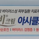 입안연고 - 앞면 및 유효성분표기 (링크x)_2 이미지