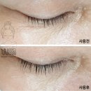 천안 속눈썹 생장술~