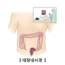 팔만대장경 전부 외우기 vs 대장내시경 8만번 하기 이미지