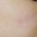 블루비타 이미지