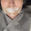 [입술필러추천]뷰커스의원 강서가양 입술필러 잘하는곳!