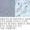 담배, 폐세포 10년 일찍 죽인다 이미지