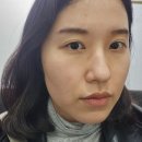 홍대 피부과 :: 홍대고운세상피부과 리프팅레이저 볼뉴머리프팅 300샷 후기