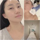 한별 | 수완지구피부관리 한별스킨바디 SQL하이푸 리프팅 후기