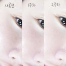 세경3차 | 레이어랩 기미흔적 클리어 세럼 잡티 미백 전후 비교 30대 2주 후기