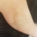 아이맘편작한의원 | &lt;다이어트&gt;대구한의원::다사편작한의원/아이맘편작한의원/야제증검사/대구다이어트한의원/소아한의원