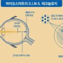 눈에존안경 이미지