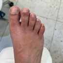 [김포/문제성발톱] 발관리 맛집 레푸스 김포한강신도시점
