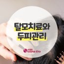 세종 탈모병원 두피,머리빠짐 수앤미