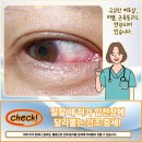 성모류마내과의원 네이버블로그