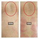 더뉴핏 | 올더뉴핏(All The New Fit)에서 받은 집중 등관리 리얼 후기