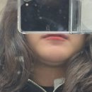 (주)조이피드 | 이중턱 지방흡입 + 근육묶기 내돈내산 리얼후기 *1탄* (수술 당일, 1~3일차 붓기, 통증, 부작용 총정리)