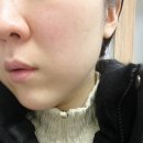 스킨앤바디 | 일산 화정 에스테틱 엘트리움 스킨앤바디 후기