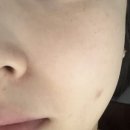 베버리힐즈피부관리 네이버블로그