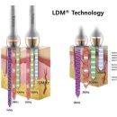 건조한 피부의 보습문제 LDM 해결 방법 이미지