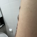 내포메디컬의원 네이버블로그