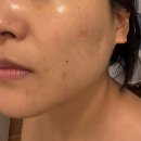 망원역(6) | 홍대 경락 마포 피부관리 미플 망원역점 윤곽관리 후기