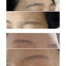 (주)우원 | 분당 눈썹 잔흔 제거 잘하는 곳 브로우원 한 달 후기 및 2차 시술까지