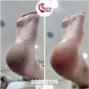 리턴스케어