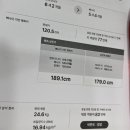 수성아동병원 X자 다리, 안짱걸음 첫 진료 후기