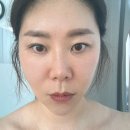 에스더 | 북구등마사지 동구피부마사지 에스더스킨케어 체험권 후기