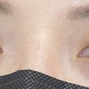 멜로래쉬 이미지