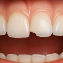 부산심미 이미지