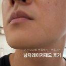 젠틀독 | 아라동피부과 남자레이저제모 인천젠틀맥스프로플러스 수염제모 효과 통증 가격