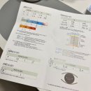 고양신세계안과의원 | 고양 신세계 안과 투데이라섹 두달차 찐 후기 (수술과정 및 통증)