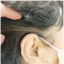 베테랑보청기 | 노원보청기 잘하는 곳 베테랑보청기 방문 후기
