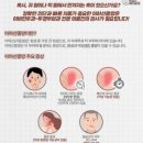 땡큐서울의원 이미지