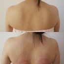 여리뷰티 | 논현역 피부관리 직각어깨 승모근여리 뷰티다룸 후기