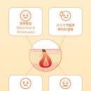 아젤리아 이미지