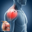 강북연세정형외과의원 이미지