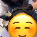 (주)준성약품 대구지점 | 대구 동성로 두피 웰킨두피탈모센터 두피진단 및 스케일링 후기