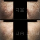 연세지움 Daum카페