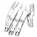 손목관절과 손의 시진, 뼈의 촉진 이미지
