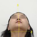 마디마디힘찬한의원 앞 | W2. 수원안면비대칭교정한의원, 단 1회로 턱관절 안면비대칭 및 두상 교정받고 고민해결