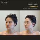 뮤 | 병점에스테틱 라즈뮤에스테틱 후기