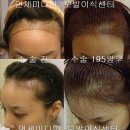 김헤어라인 이미지
