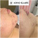 피부애 이미지