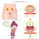 피지오스 이미지